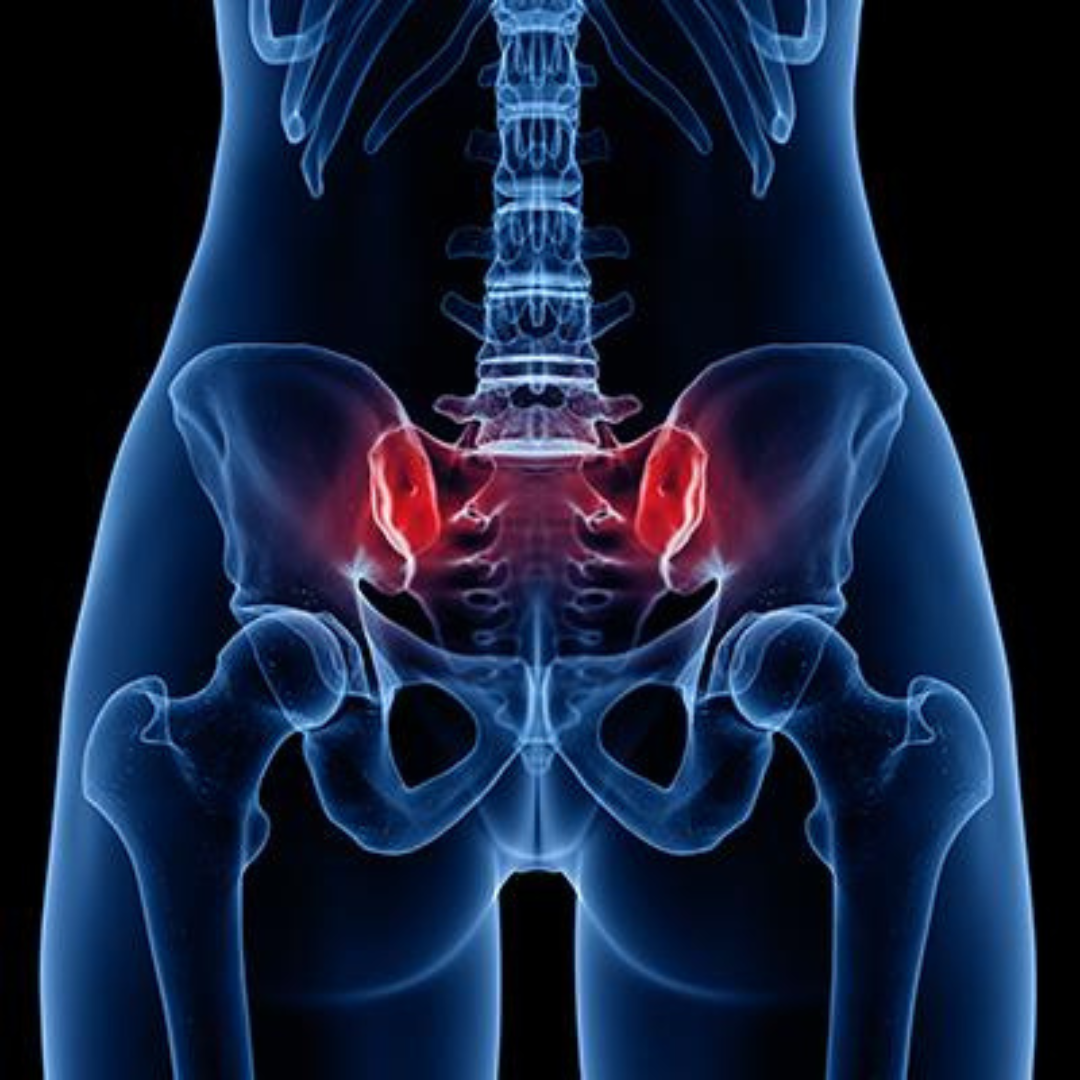 SI Joint Strain Solutions: Aspire Clinic Approach